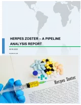 Herpes Zoster - A Pipeline Analysis Report